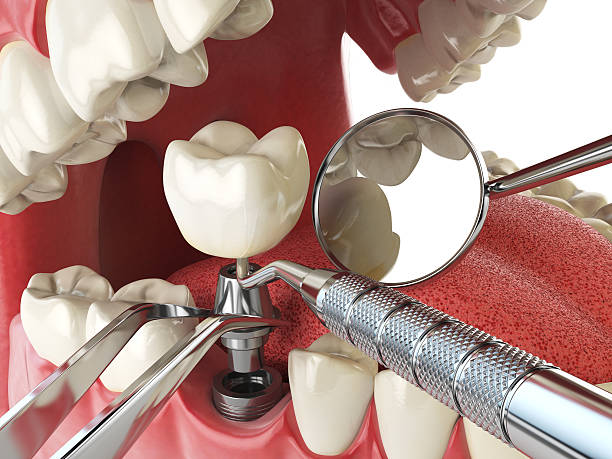 Best 24-Hour Emergency Dental Care in Chevy Chase, MD